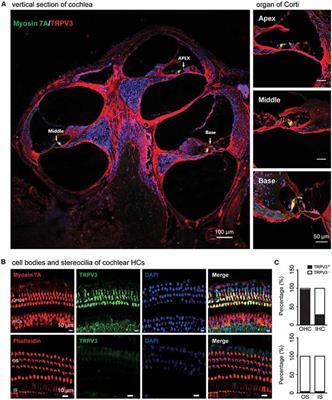 Transient Receptor Potential Cation Channel Subfamily Vanilloid 4 and 3 in the Inner Ear Protect Hearing in Mice